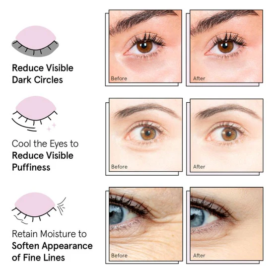 Under Eye Masks For Puffy Eyes