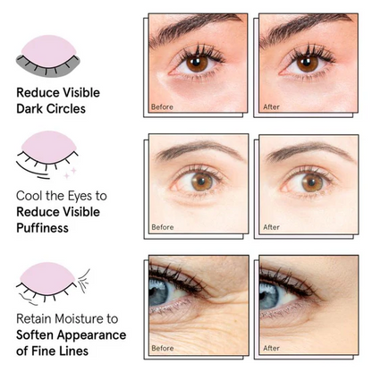 Under Eye Masks For Puffy Eyes